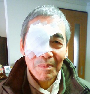 眼帯がデカイ 眼帯がデカイ